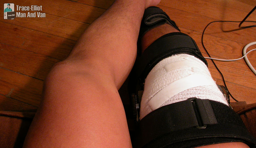 Bandaged Leg